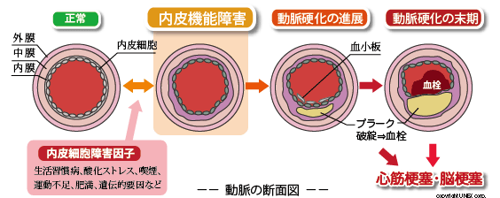 動脈の断面図